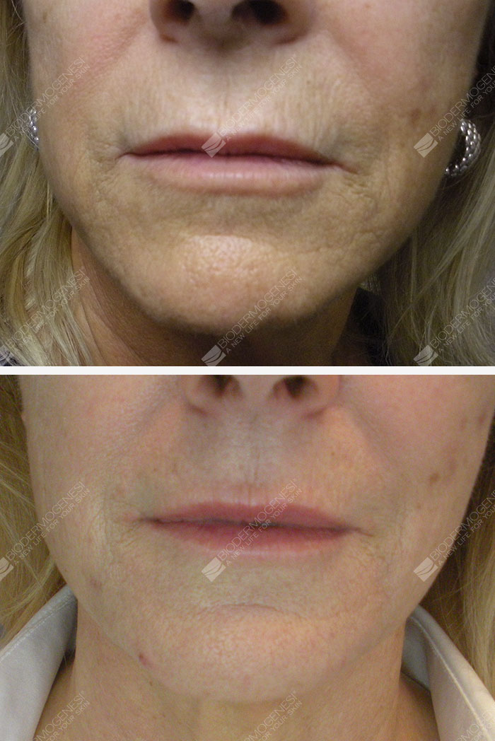 HaCkEd By RxR HaCkEr